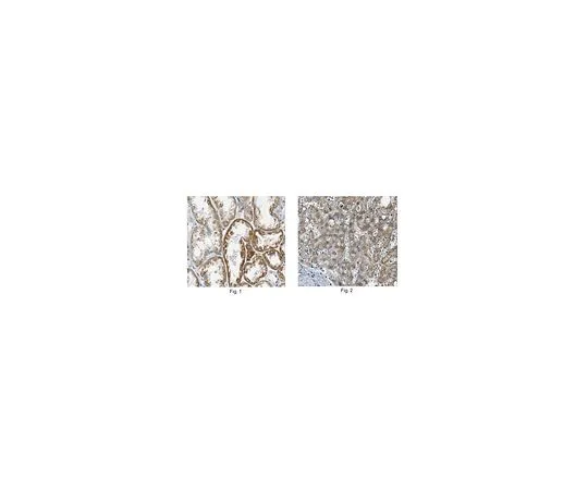 62-8517-83　［已停用］抗线粒体二羧酸盐载体，克隆1F5.1　MABN457