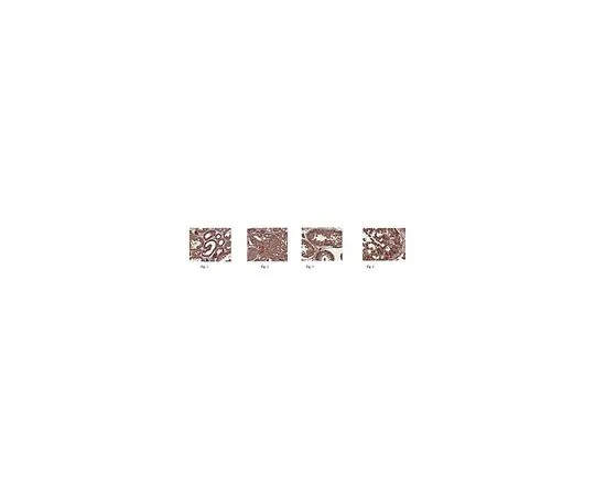 62-8501-59　［已停用］Anti-Smac/Diablo,克隆3A9.1　MABC174