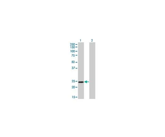 62-8481-44　［已停用］抗TWIST1小鼠mAb (3E11)　DR1087-100UG