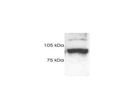 62-8435-37　［已停用］抗19S蛋白酶体S2亚基兔pAb　539166-100UL