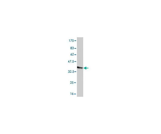 62-8533-71　［已停用］抗FCGR2A小鼠mAb (3E8)　ST1571-100UG