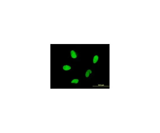 62-8481-39　［已停用］抗HMGA2小鼠mAb (2D10)　DR1073-100UG