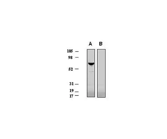 62-8529-87　［已停用］抗P2X4受体 (373-388) 兔pAb　PC376-100UG