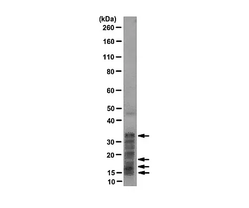 61-0210-01　［已停用］Typek/Tyvek G.Stearothermophilus中的Apex不锈钢盘 (#7953) 106 100盘　NAS-152