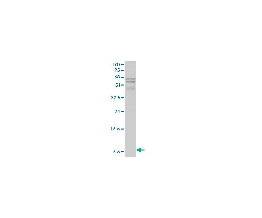 62-8528-45　［已停用］抗APOC1小鼠mAb (2E2-1A3)　NE1037-100UG