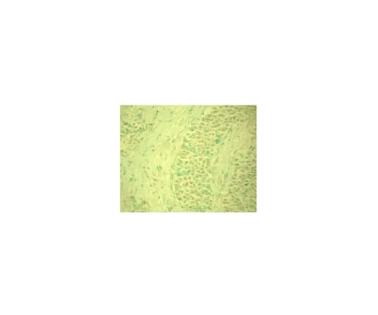 62-8529-39　［已停用］抗MDM2 (Ab-4) 小鼠mAb (2A9C1.18)　OP144-100UG