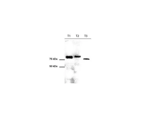 62-8533-44　［已停用］抗PAN TORC (1-42) 兔pAb　ST1098-50UL