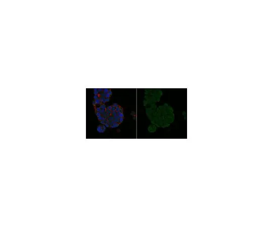 62-8500-44　［已停用］抗MGMT抗体，克隆MT 3.1, Alexa Fluor (R) 488共轭　MAB16200-AF488