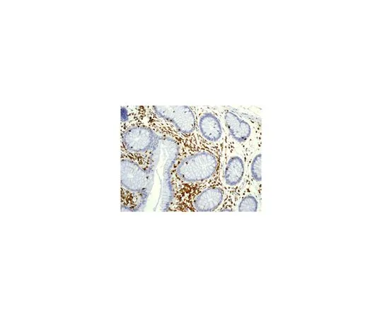 62-8523-11　［已停用］抗LSP1,克隆EPR5997,兔单克隆　MABS741