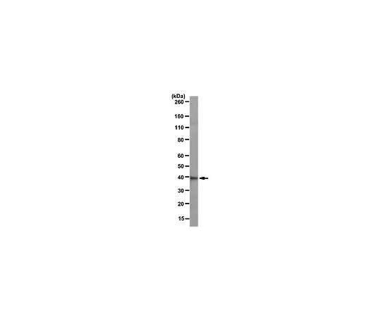 62-8521-77　［已停用］抗醛糖还原酶，克隆CPTC-AKR1B1-1;100μg　MABS18