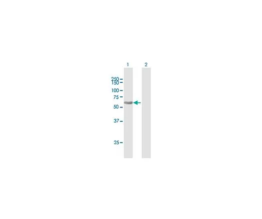 62-8481-35　［已停用］抗SQSTM1鼠标pAb　DR1056-50UG