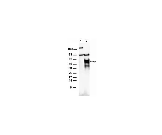 62-8533-46　［已停用］抗Kpnβ1兔pAb　ST1102-50UG