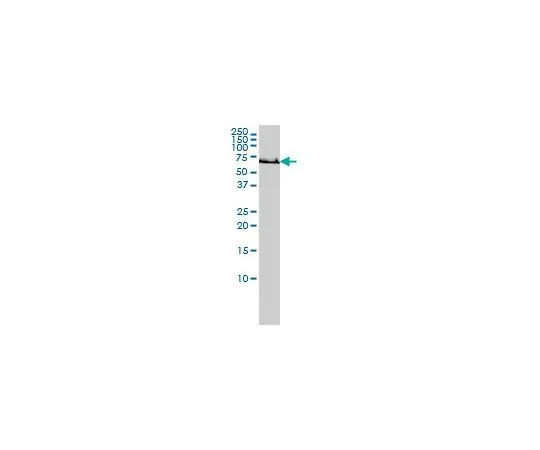 62-8481-32　［已停用］抗GCLC小鼠mAb (3H1)　DR1045-100UG