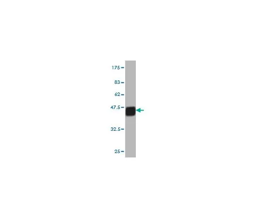 62-8533-80　［已停用］抗APLN小鼠mAb (2A1-2D5)　ST1602-100UG