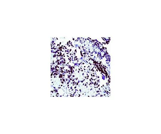 62-8478-61　［已停用］抗Wilm肿瘤蛋白兔pAb　CA1026-50UL