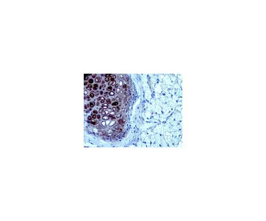 62-8525-47　［已停用］抗连接蛋白1 (Crtl1) ，克隆8-A-4;100μg　MABT85