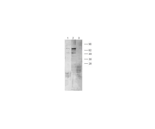 62-8533-41　［已停用］抗Paxillin (pSer178) 兔pAb的磷检测 (TM)　ST1069-50UG