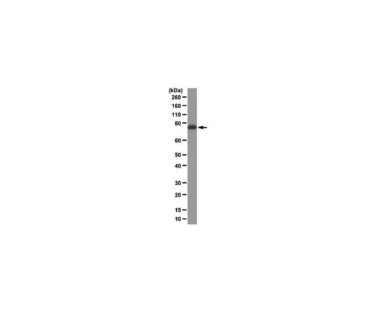 62-8521-73　［已停用］抗GRK6,克隆4B11.2;100μg　MABS12
