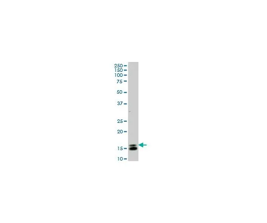 62-8481-50　［已停用］抗ID1小鼠mAb (1F7)　DR1098-100UG