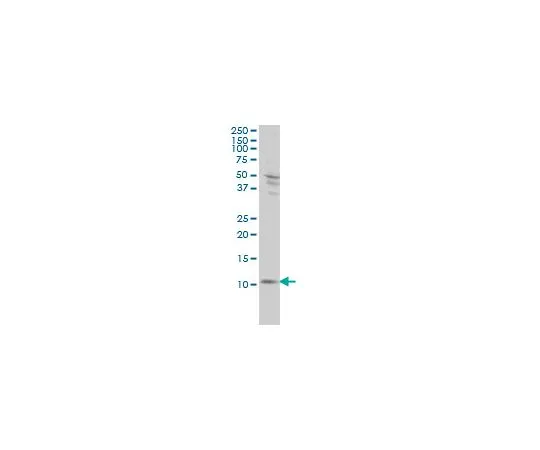 62-8478-83　［已停用］抗S100A4鼠标mAb (1F12-1G7)　CB1039-100UG