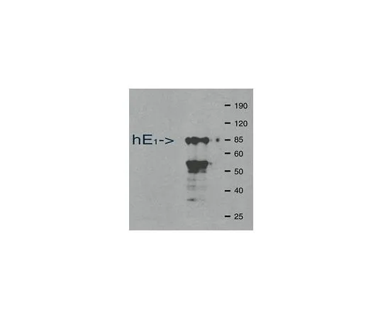 62-8495-17　［已停用］抗泛素激活酶E1,克隆2G2.3;100μg　MAB3520