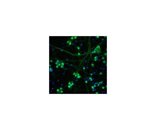 62-8497-27　［已停用］抗神经丝200kDa,克隆NE14,生物素结合;100μL　MAB5256B